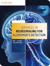 Advances In Neuroimaging For Alzheimer Advances In Neuroimaging For Alzheimer